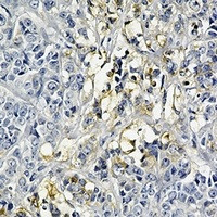 HK2 Antibody in Immunohistochemistry (Paraffin) (IHC (P))