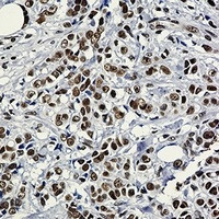 HSF1 Antibody in Immunohistochemistry (Paraffin) (IHC (P))