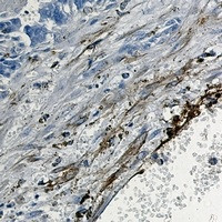 ITGA5 Antibody in Immunohistochemistry (Paraffin) (IHC (P))