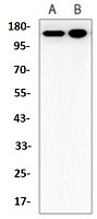 JAK2 Antibody in Western Blot (WB)