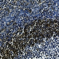 LTA4H Antibody in Immunohistochemistry (Paraffin) (IHC (P))