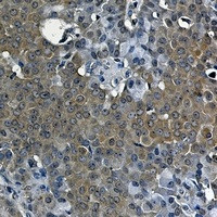 NR1H3 Antibody in Immunohistochemistry (Paraffin) (IHC (P))