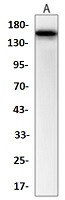 ABCB1 Antibody in Western Blot (WB)