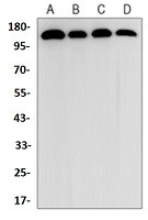 EIF2AK3 Antibody in Western Blot (WB)