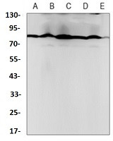 PRMT7 Antibody in Western Blot (WB)