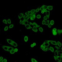 UPF1 Antibody in Immunocytochemistry (ICC/IF)