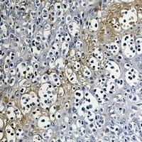PEBP1 Antibody in Immunohistochemistry (Paraffin) (IHC (P))