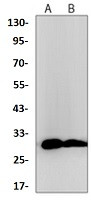 TMEM192 Antibody in Western Blot (WB)