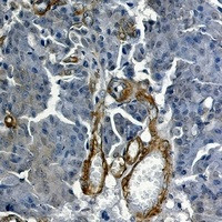 VCL Antibody in Immunohistochemistry (Paraffin) (IHC (P))