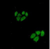 WNT5A Antibody in Immunocytochemistry (ICC/IF)