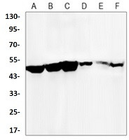 HAVCR1 Antibody in Western Blot (WB)