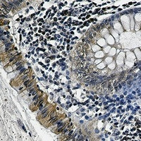 SPP1 Antibody in Immunohistochemistry (Paraffin) (IHC (P))