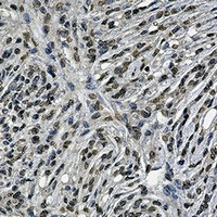 BCR Antibody in Immunohistochemistry (Paraffin) (IHC (P))