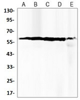 PPP3CA Antibody in Western Blot (WB)