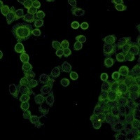 COL1A1 Antibody in Immunocytochemistry (ICC/IF)