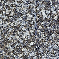 DGKA Antibody in Immunohistochemistry (Paraffin) (IHC (P))