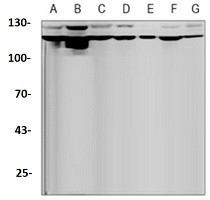 DGKZ Antibody in Western Blot (WB)