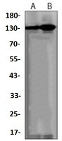 DNMT3A Antibody in Western Blot (WB)