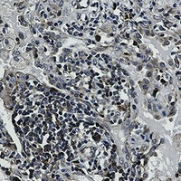 EIF4B Antibody in Immunohistochemistry (Paraffin) (IHC (P))