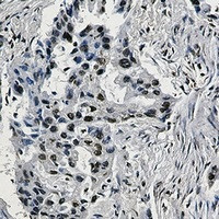 ARNT Antibody in Immunohistochemistry (Paraffin) (IHC (P))
