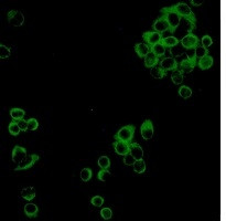IMPDH2 Antibody in Immunocytochemistry (ICC/IF)
