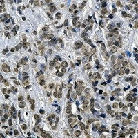 KEAP1 Antibody in Immunohistochemistry (Paraffin) (IHC (P))