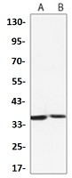 L1RE1 Antibody in Western Blot (WB)