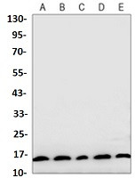 MAP1LC3A Antibody in Western Blot (WB)
