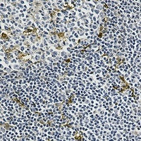 MERTK Antibody in Immunohistochemistry (Paraffin) (IHC (P))