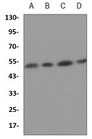 P2RY12 Antibody in Western Blot (WB)