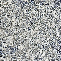 PTBP1 Antibody in Immunohistochemistry (Paraffin) (IHC (P))