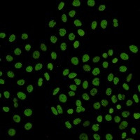 RAD21 Antibody in Immunocytochemistry (ICC/IF)