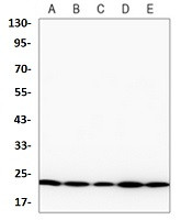 NRAS Antibody in Western Blot (WB)