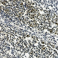 RPS20 Antibody in Immunohistochemistry (Paraffin) (IHC (P))
