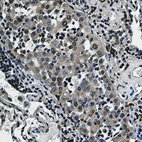 RPS6KA3 Antibody in Immunohistochemistry (Paraffin) (IHC (P))