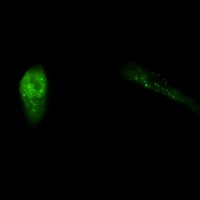 SQSTM1 Antibody in Immunocytochemistry (ICC/IF)