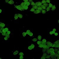 STAT5B Antibody in Immunocytochemistry (ICC/IF)
