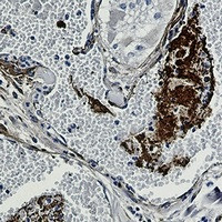 THBS1 Antibody in Immunohistochemistry (Paraffin) (IHC (P))