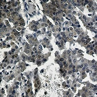 CRTC2 Antibody in Immunohistochemistry (Paraffin) (IHC (P))