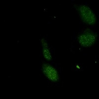 UBE2I Antibody in Immunocytochemistry (ICC/IF)
