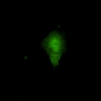 NAMPT Antibody in Immunocytochemistry (ICC/IF)