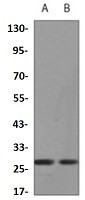 XBP1 Antibody in Western Blot (WB)