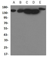 YTHDC2 Antibody in Western Blot (WB)