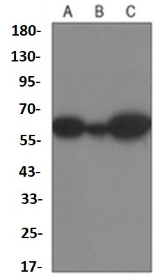 YTHDF1 Antibody in Western Blot (WB)