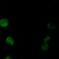 PRKCB Antibody in Immunocytochemistry (ICC/IF)