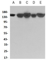 KDM4A Antibody in Western Blot (WB)