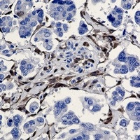 ALDH1A1 Antibody in Immunohistochemistry (Paraffin) (IHC (P))