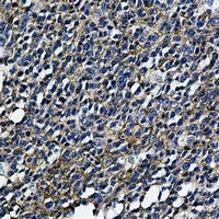 HLA-A Antibody in Immunohistochemistry (Paraffin) (IHC (P))