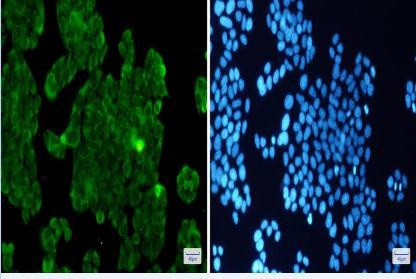 PPP1CB Antibody in Immunocytochemistry (ICC/IF)