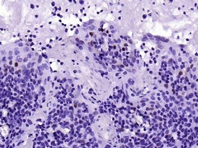 CCND1 Antibody in Immunohistochemistry (Paraffin) (IHC (P))